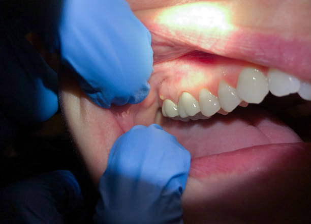 Best Emergency Orthodontic Repairs in Morton, MS