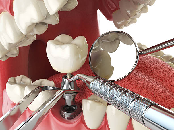 Best Same-Day Emergency Dentist in Morton, MS