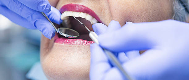 Best Emergency Wisdom Teeth Removal in Morton, MS